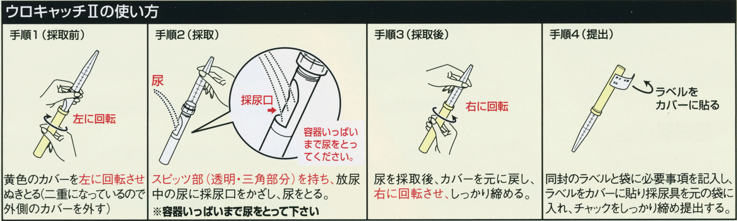 ウロキャッチの使い方