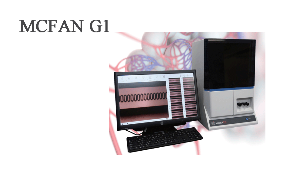 MCFAN G1
