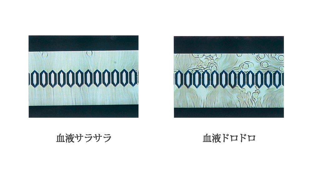 血液サラサラ